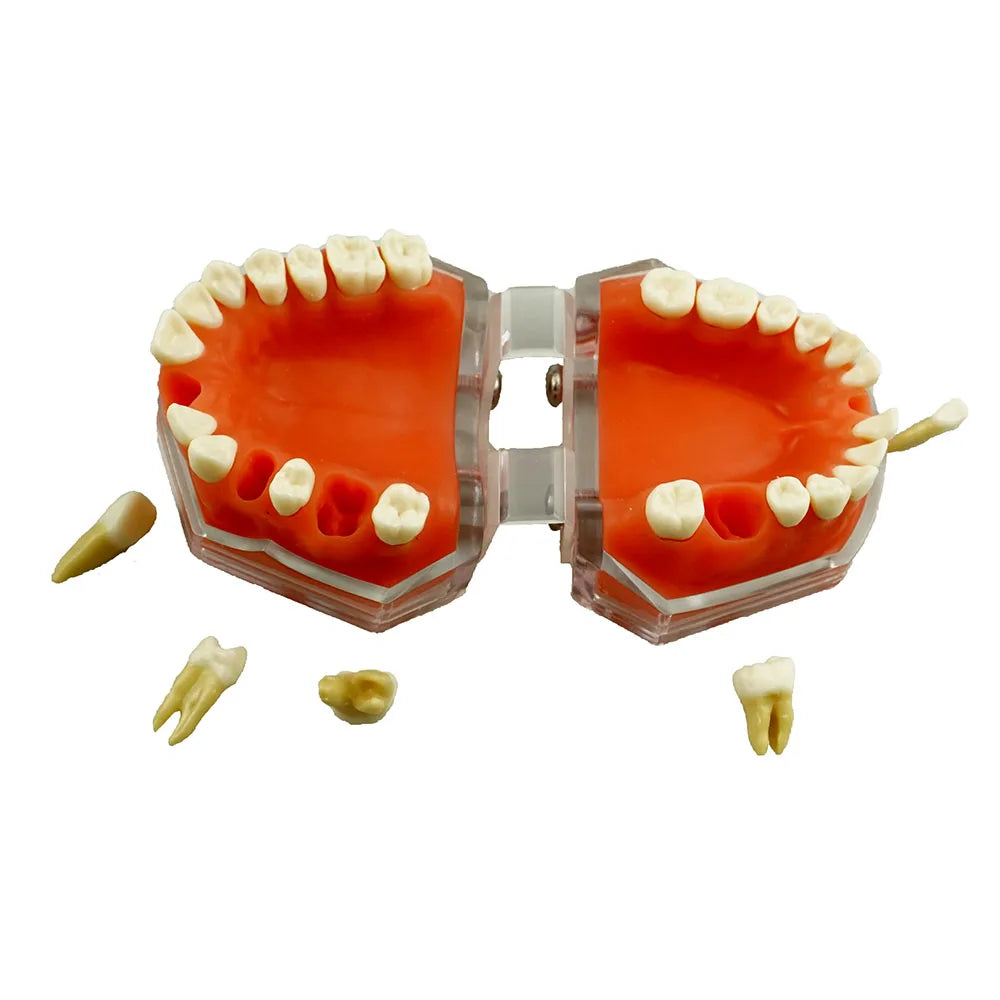 1:1 Dental Restoration Model Gingival Model Dentistry Clinic Patient Demonstration Teeth Model Silicone Material Dentist Tools