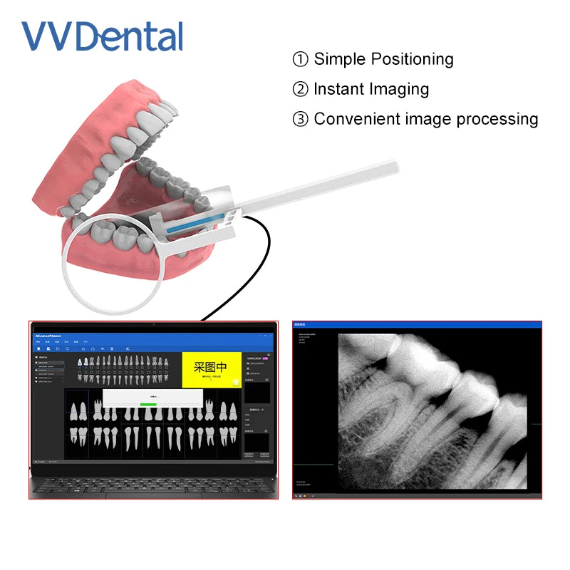 VVDental Dental Sensor X-Ray Radiovisiograph Digital Sensor Intraoral Imaging System HD Image Dentistry Tool