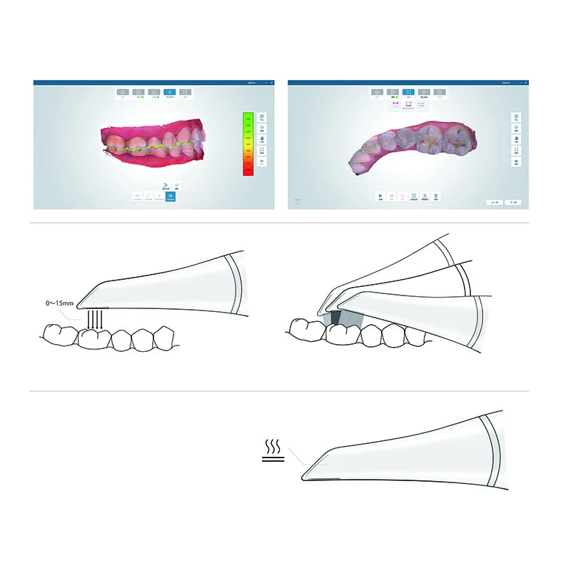 China inter oral 3d scanner 3d scanner oral for dentists