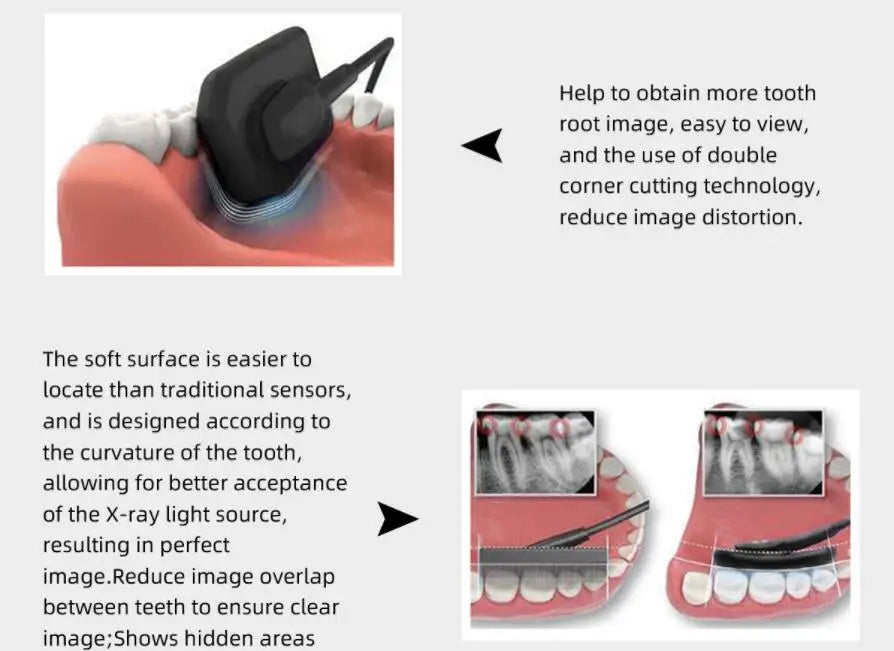 Digital Sensor ECO Sensor with Holder Intra Oral Imaging System RVG X Ray Sensor For Medical Film Dentist Equipment