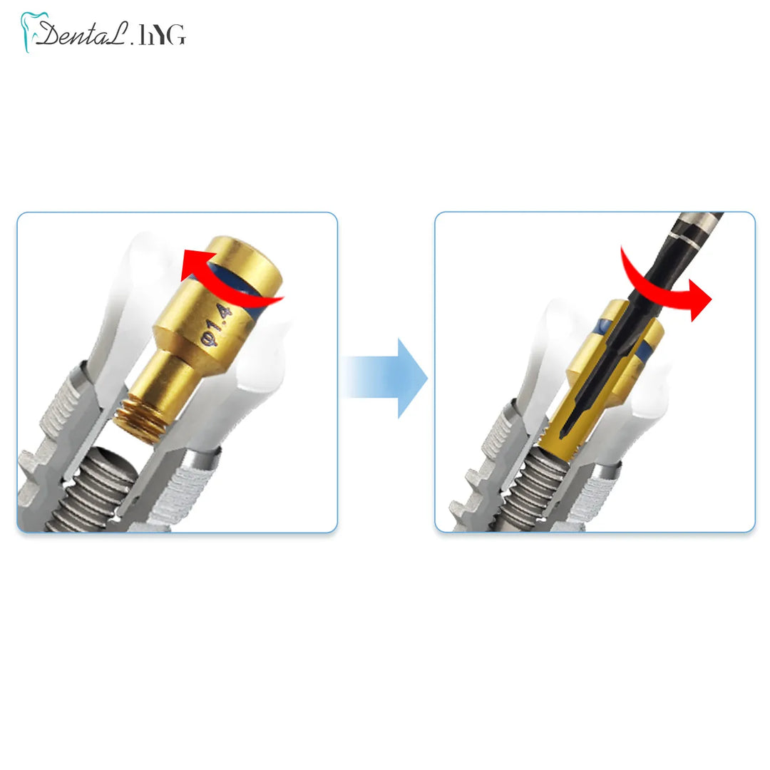 1Set Dental Implant Remover Kit Drill Guide Extraction Sit Broken Fixture Surgical Instrument Dental Tool Screw