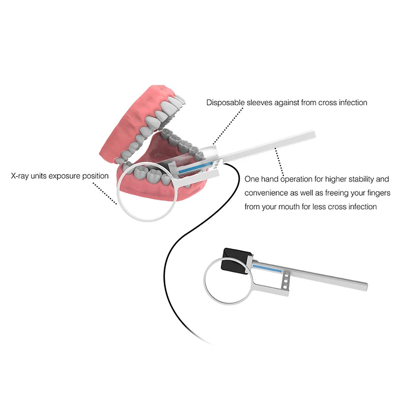 VVDental Dental Sensor X-Ray Radiovisiograph High-Frequency Rx Digital Sensor Intraoral Imaging System HD Image Dentistry Equipm