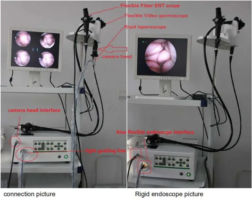 24full hd 1920x1080 165 hz veterinary gastroscope endoscope