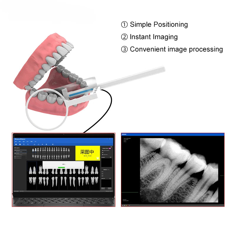 VVDental Dental Sensor X-Ray Radiovisiograph High-Frequency Rx Digital Sensor Intraoral Imaging System HD Image Dentistry Equipm