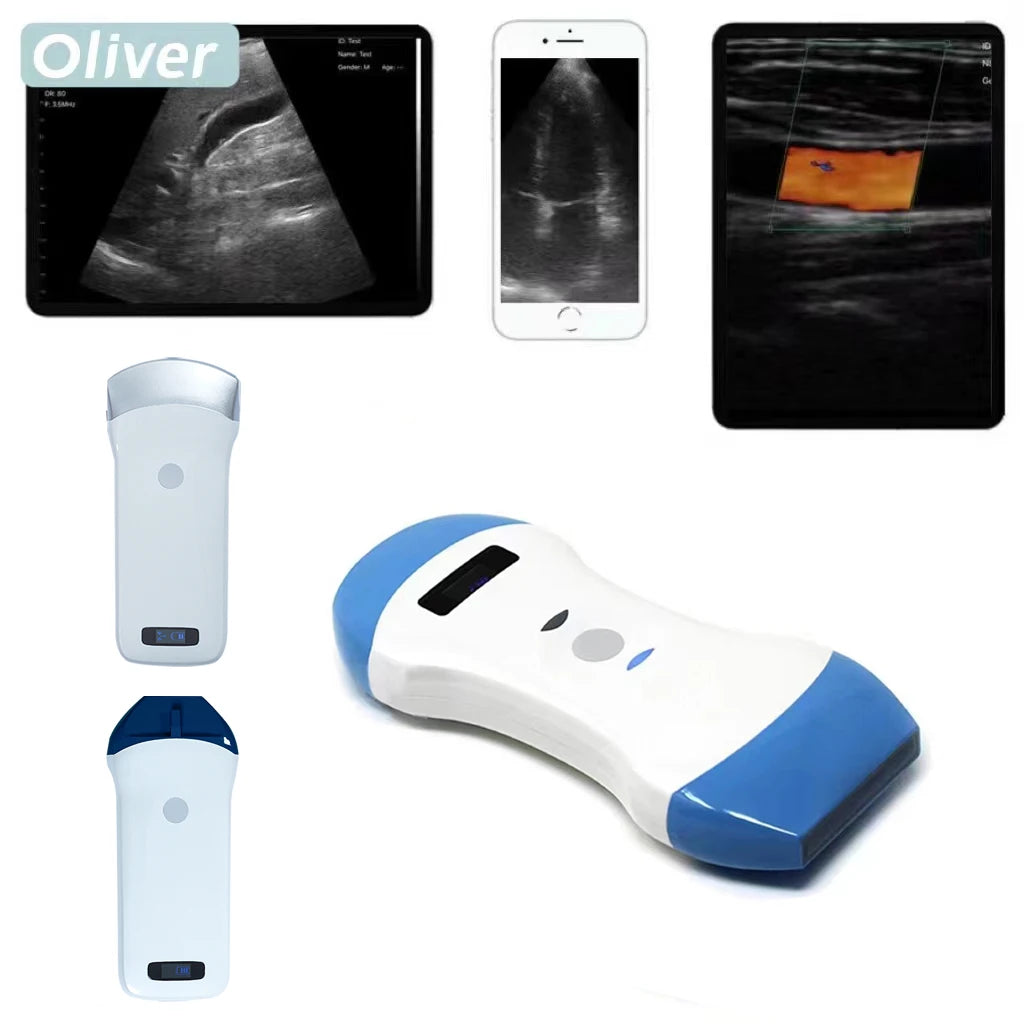 Wireless Ultrasound Probe scanner portable Bluetooth machine WIFI ultrasound scanner Machine support iOS Android Windows USG