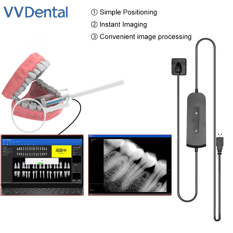 VVDental Dental Sensor X-Ray Radiovisiograph Digital Sensor Intraoral Imaging System HD Image Dentistry Tools Portable Sensor