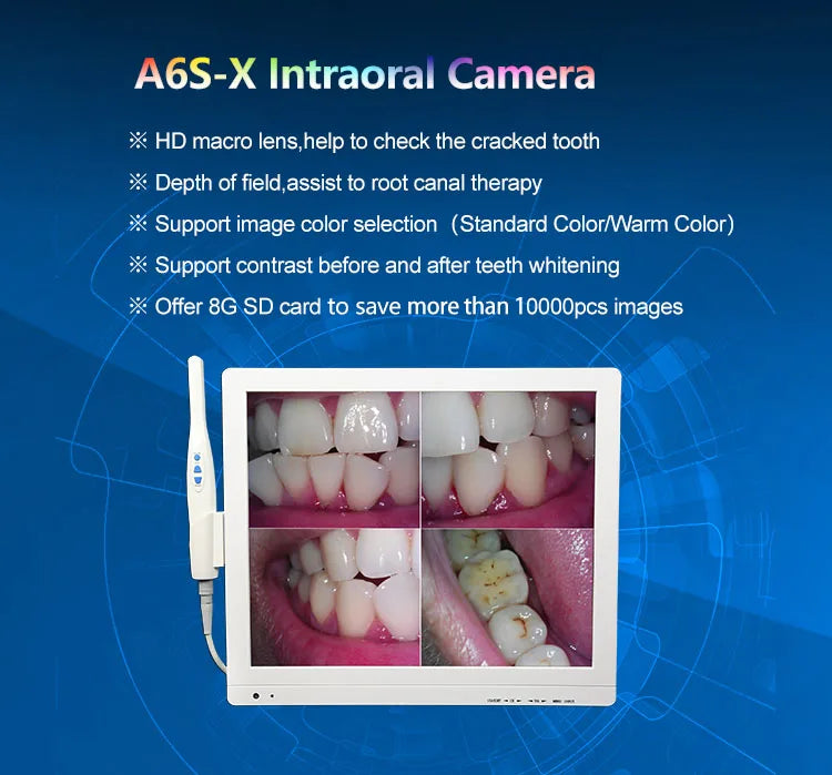 LCD   intraoral camera A6S-X  equipment for dentist intraoral camera  camara oral camera