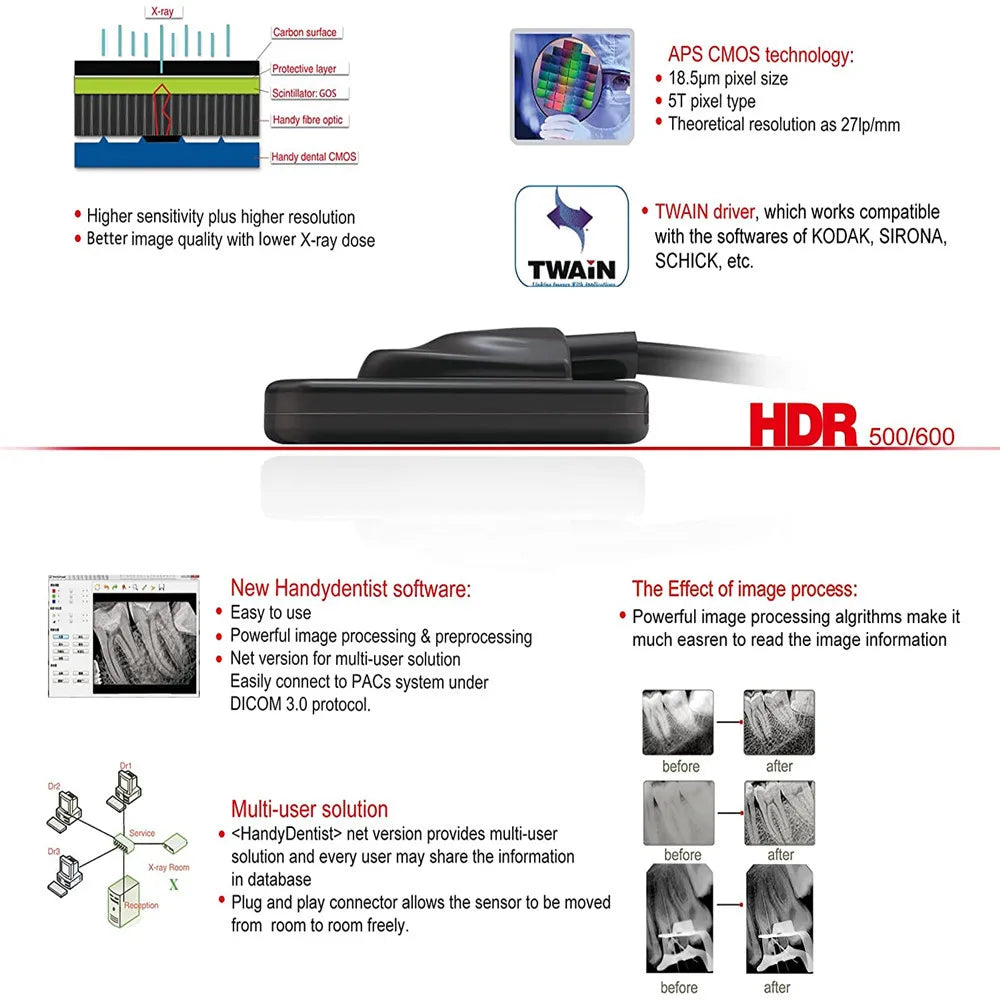 Hot Sell hdr 600 Sensor Dental Digital Size 2 Fit Win 7, Win 8,Win 10 System Intraoral Image Clinic Equipment Dentist Use