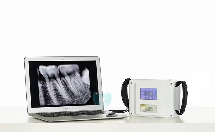 Wireles Portable Xray Machine Touch Screen Dentists Digital Ray images System portable Dentists  machine