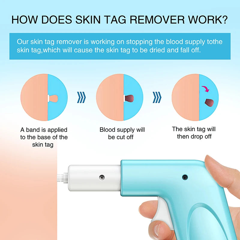 1 Set 3 In 1 Auto Skin Tag Remover Painless Mole Wart Removal Kit Device Professional Face Care Beauty Tool Home Use