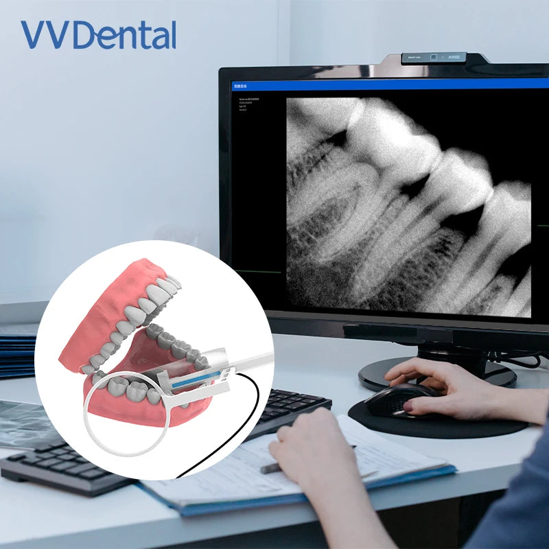 VV Dental Sensor X-Ray Radiovisiograph High-Frequency Digital Intraoral Digital System Image Dentistry Tool