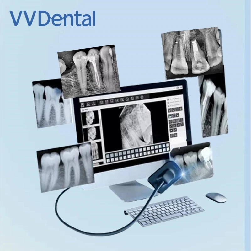 VV Dental Sensor X-Ray Radiovisiograph High-Frequency Digital Intraoral Digital System Image Dentistry Tool